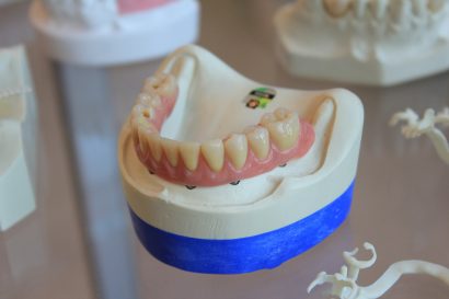 Dental prosthetic model showing natural-looking teeth and gums — used to illustrate professional in-office whitening results.